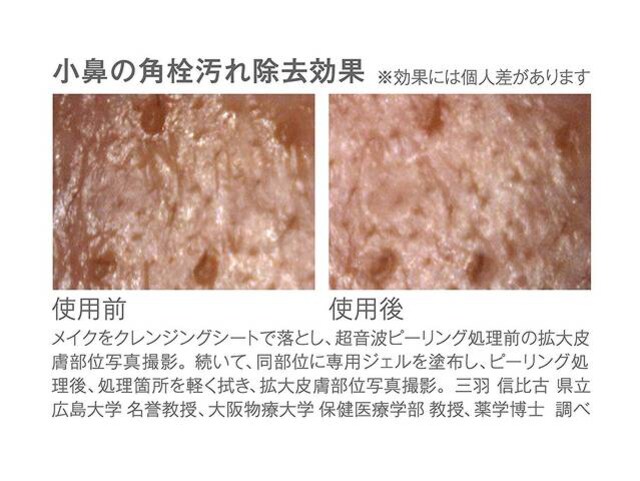 KOIZUMI rW[i(Bijouna) gs[O  Ɠd/AV 